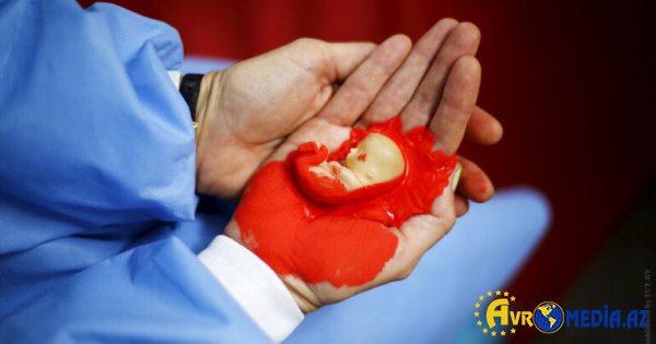 Azərbaycanda abortla bağlı dəhşətli statistika