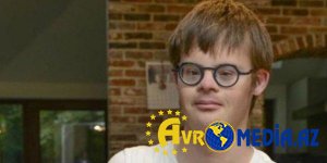 Daun sindromu üçün yeni dərman icad edildi