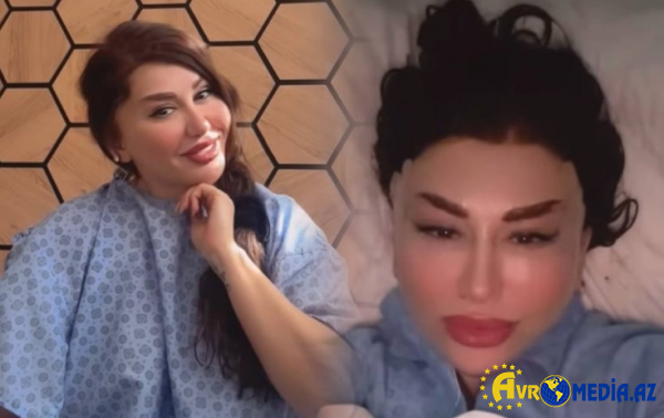 Fatimə yenidən plastik əməliyyat etdirdi
