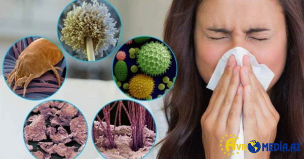 Allergiyası olanların NƏZƏRİNƏ