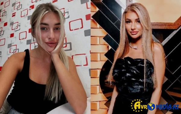 Faciəvi şəkildə öldü