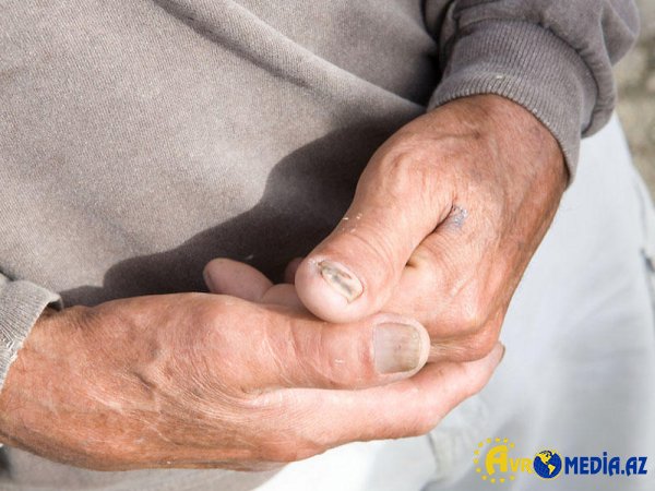 Yaşı 50-dən yuxarı olanlar bu xəbər mütləq OXUSUN
