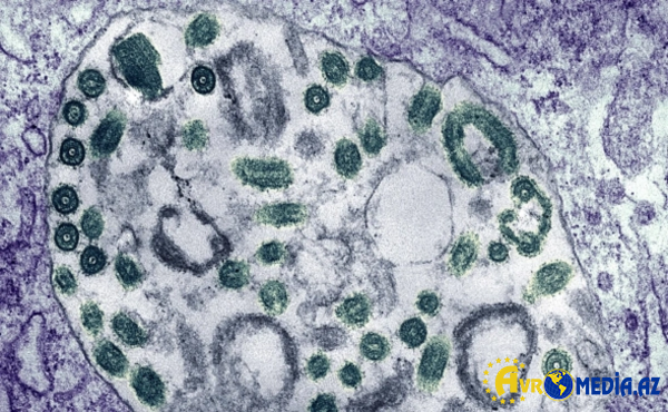 Evi təmizləyəndə çıxan toz da hantavirus yarada bilər.
